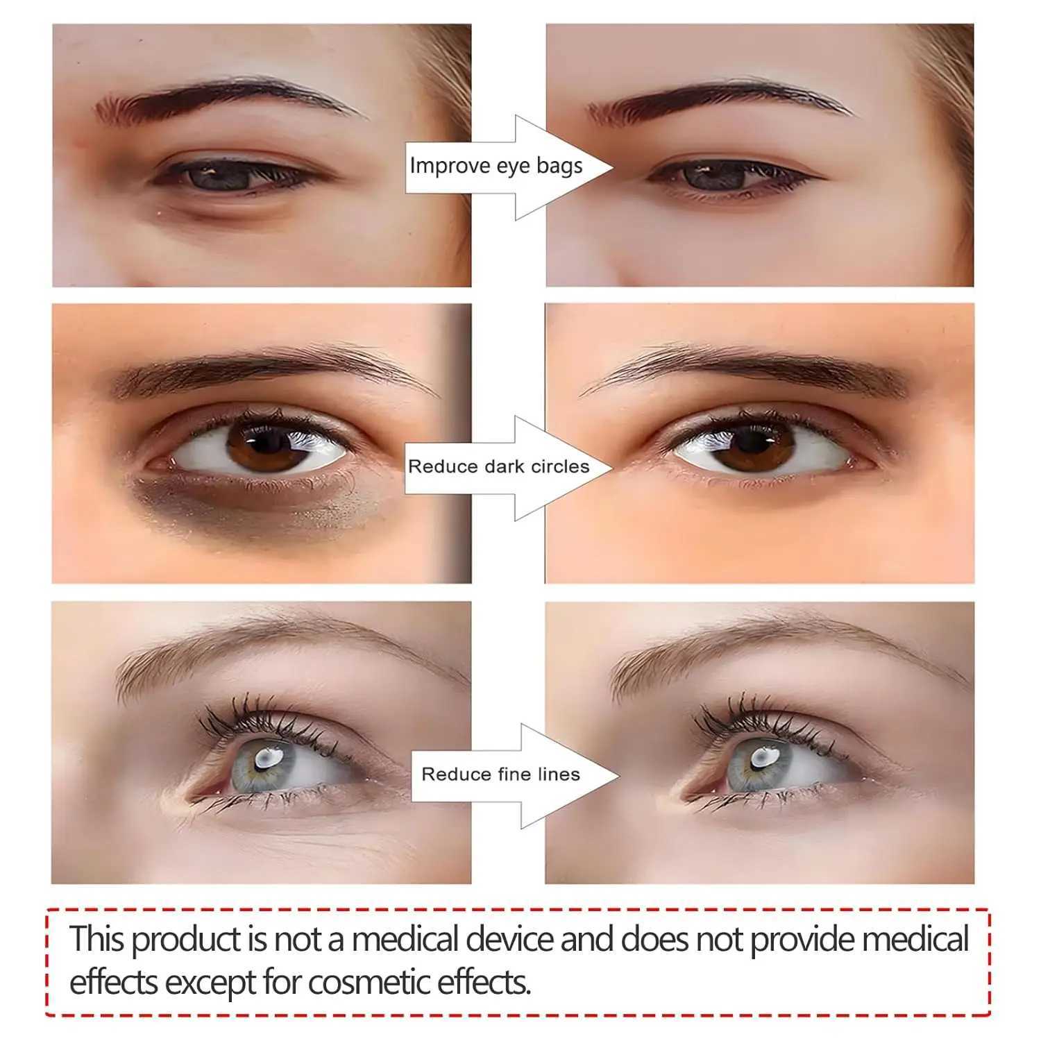 3D EMS Eye Beauty Instrument Micro-Current Pulse Eye Relax Reduce Wrinkles and Dark Circle Remove Eye Bags Massager Beauty Tool W241213