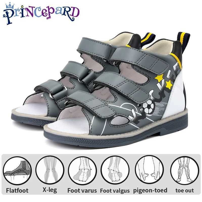 Sandals Children Summer Sandals Princepard Kids Girls Boys Orthopedic Shoes High Top Arch Support Varus Valgus Footwear H241213