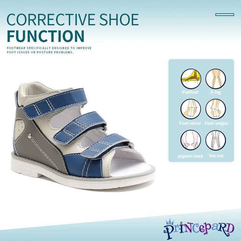 Sandals Children Summer Sandals Princepard Kids Girls Boys Orthopedic Shoes High Top Arch Support Varus Valgus Footwear H241213