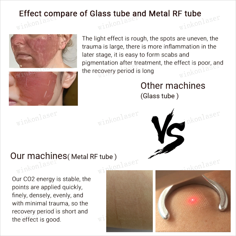 70W CO2 Fractional RF laser face resurfacing machine skin rejuvenation vaginal tightening 3IN1 beauty equipment