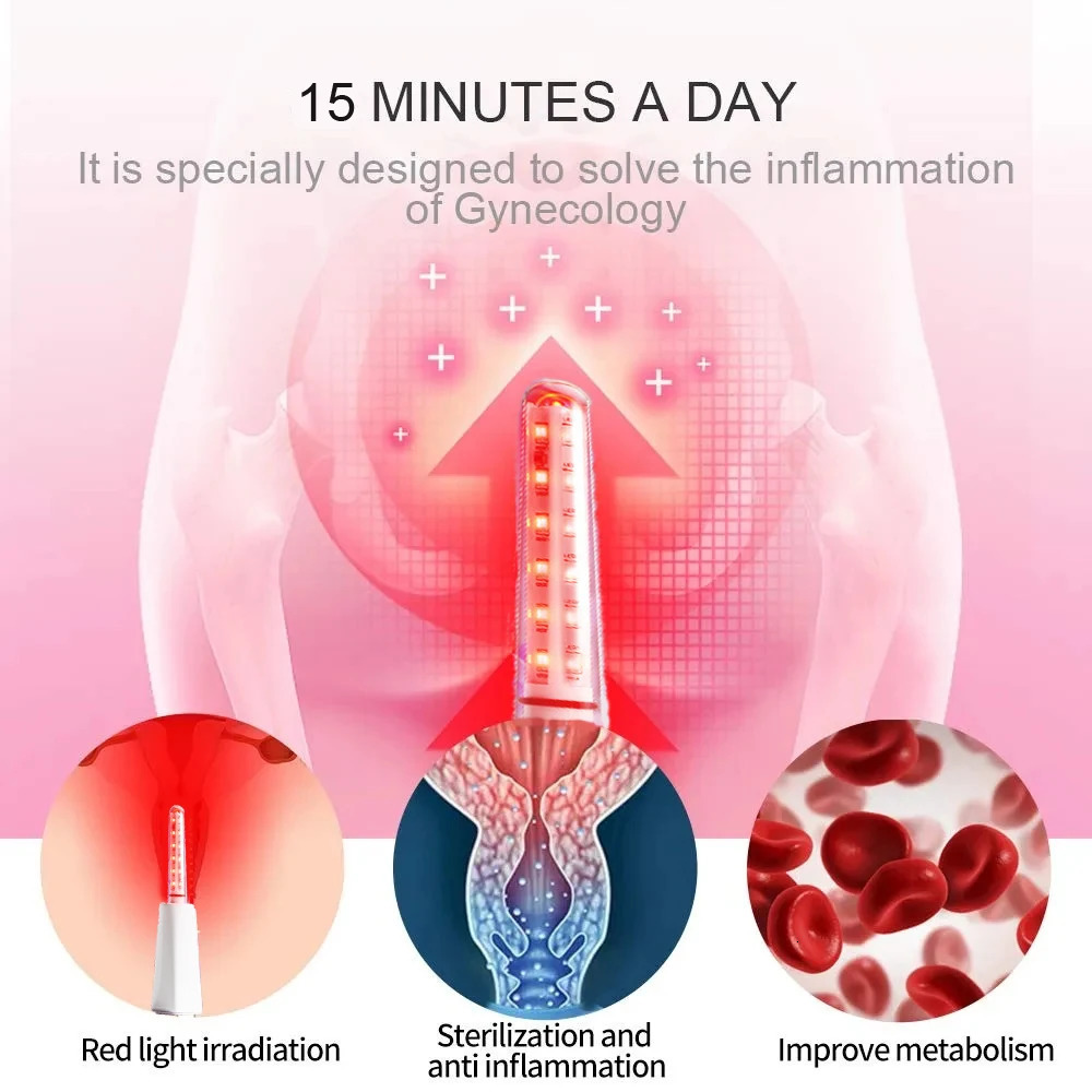 Female Vaginitis Treatment Equipment LED Vaginal Massage Home Use Red Blue Light for Women 241213