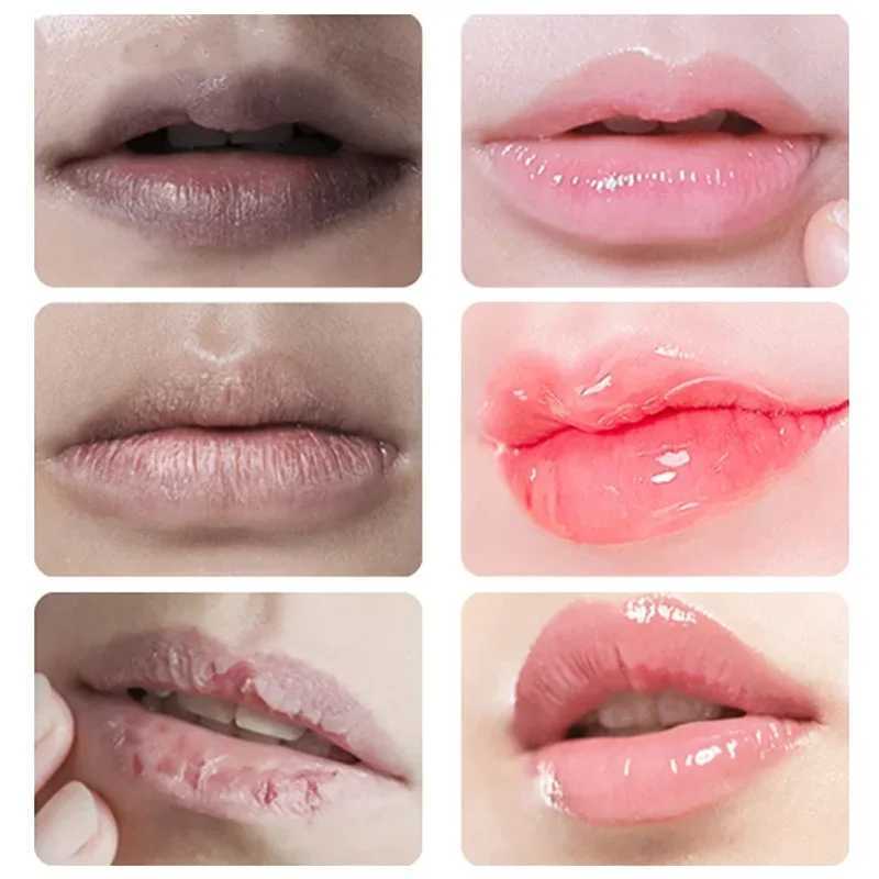 Lipstick whitening removing dark lip color moisturizing exfoliating cleaning reducing lip line cosmetic lipstickW241223