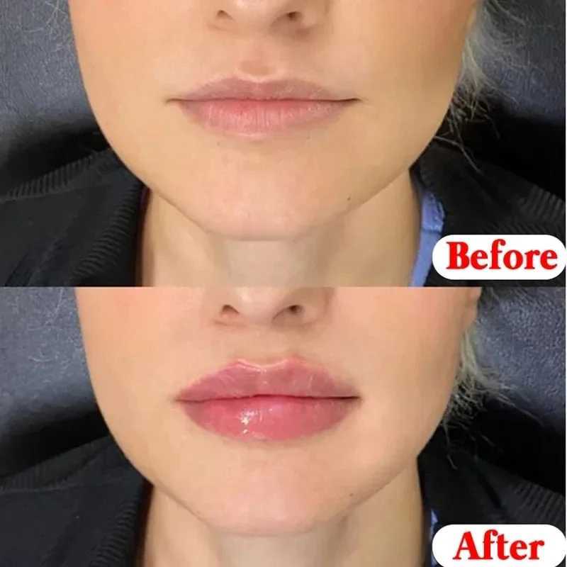 Vaseline lipstick moisturizing and removing melanin anti crack lipstick basic lipstick beauty cosmeticsW241223