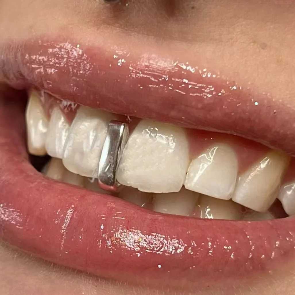 YOUNGX Hip Hop Simple Glossy Long Stick Teeth Grillz 14K Gold Plated Vertical Bar Tooth Cs For Women Men Bo Punk JewelryXJ241225