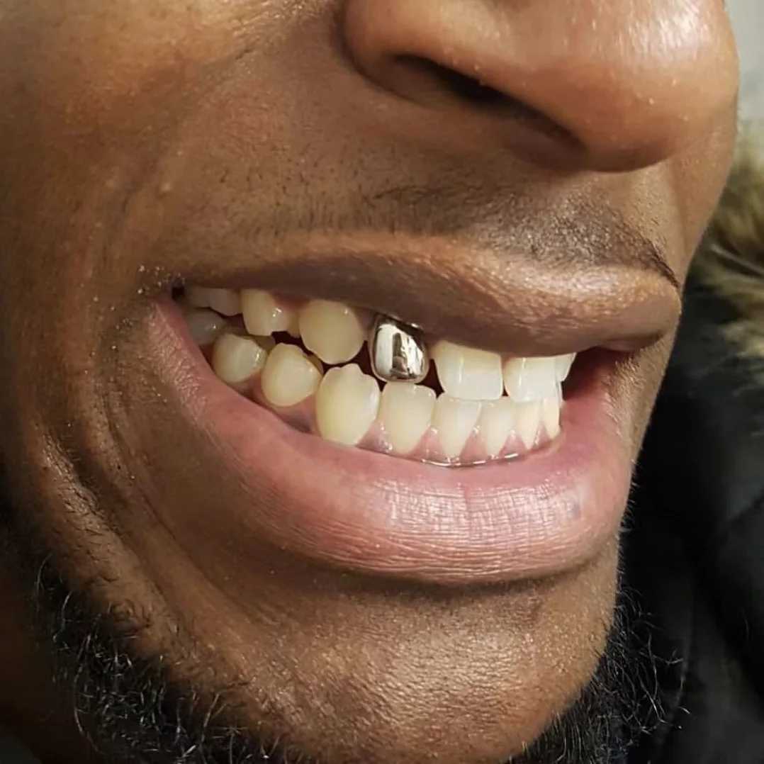YOUNGX Classic Single Small Teeth Grillz Hip Hop 14K Gold Plated Glossy Tooth Cs For Women Men Jewelry Party GiftXJ241225