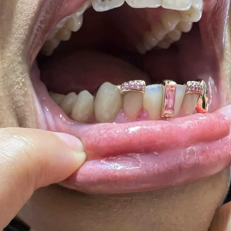 RACHELZ Hip Hop Single Pink Green Zircon Vertical Row Teeth Grill 14K Gold Plated Crystal Tooth Cs For Women Men JewelryXJ241225