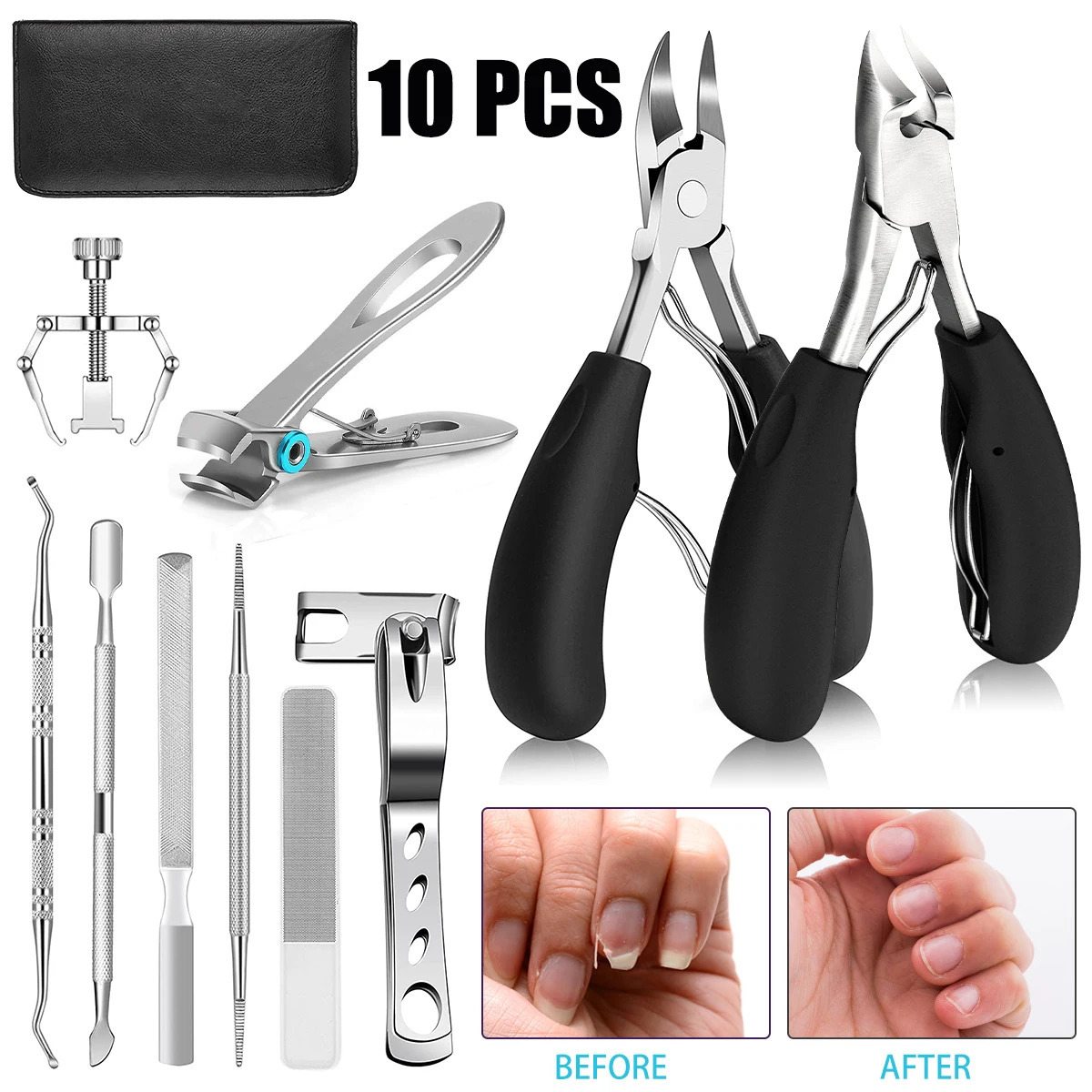 10Pcs Ingrown Toenail Clippers Kit Stainless Steel Ingrown Toenail Removal Kit Toenail Clippers Set for Ingrown and Thick Nail 241225