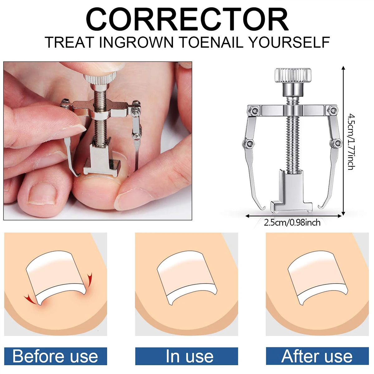10Pcs Ingrown Toenail Clippers Kit Stainless Steel Ingrown Toenail Removal Kit Toenail Clippers Set for Ingrown and Thick Nail 241225