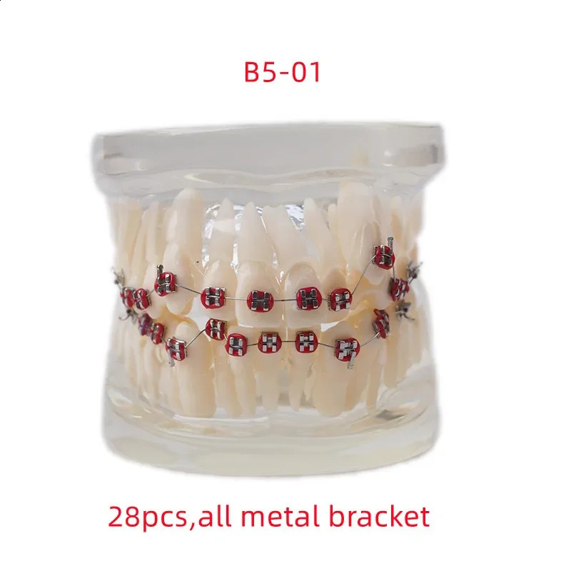 Dental Teaching Model Ortho Metal Bracket Metal Ceramic Dentistry Accessories Orthodontics False Teeth Modeling Tools 241226