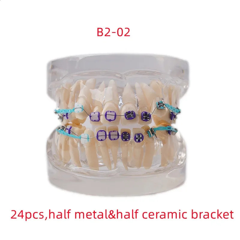 Dental Teaching Model Ortho Metal Bracket Metal Ceramic Dentistry Accessories Orthodontics False Teeth Modeling Tools 241226