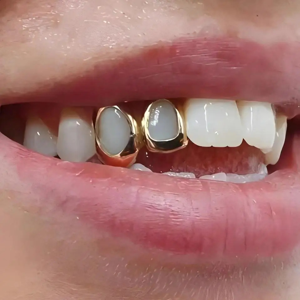 All Hollow Unique Style Bling Iced Out Teeth Hip Hop Top Bottom Grills Dental Mouth Punk Teeth Caps Cosplay Party TG136 241226
