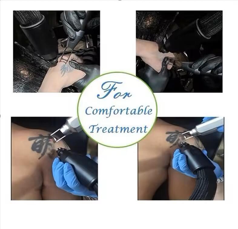 High quality Cold Therapy Machine -35 Degree Cryo Cooling Machine Cryo Skin Cooling system skin air cooling machine,cold For Pain Relief During Laser 