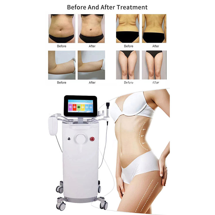 Contoura Fractora Lift MiniFX Anti-Aging RF Body Treatment Machine 2-in-1 Diamond Superplasticity
