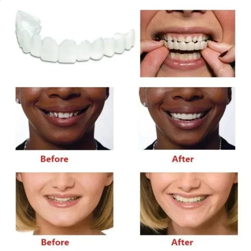 Perfect fit teeth whitening denture cover silicone smile veneer upper teeth beauty tools cosmetic teeth free delivery 240919