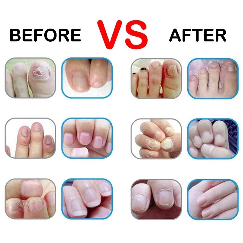 15 Smells Nail Nutrition Oil Pen Nail Treatment Cuticle Revitalizer Oil Prevent Agnail Nail Polish Nourish Skin Nail Treatment 240701