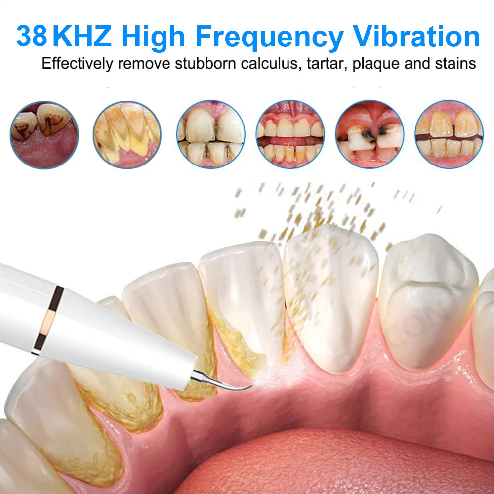 Ultrasonic Dental Tartar r Electric Ultra Sonic Dental Calculus r Plaque Removal Dental Tartar Eliminator 240701