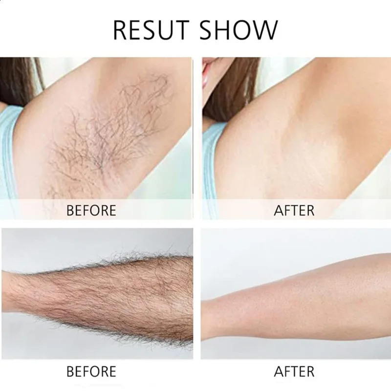 Woman Epilator Hair r for Ladies Professional Machine Trimmer Body Leg Rechargeable Depilation 240701