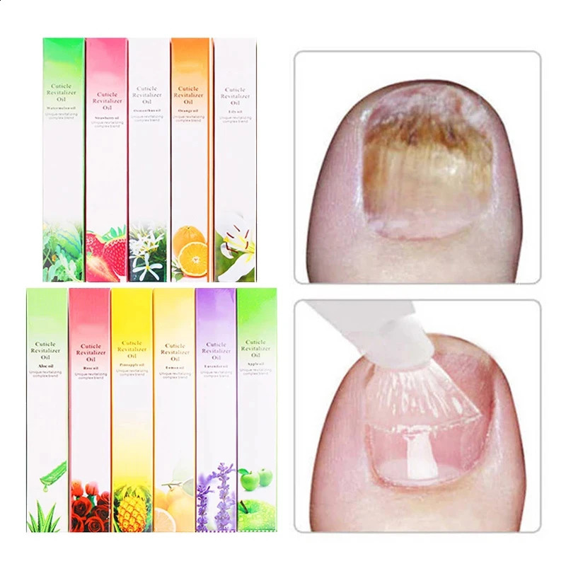 15 Smells Nail Nutrition Oil Pen Nail Treatment Cuticle Revitalizer Oil Prevent Agnail Nail Polish Nourish Skin Nail Treatment 240701