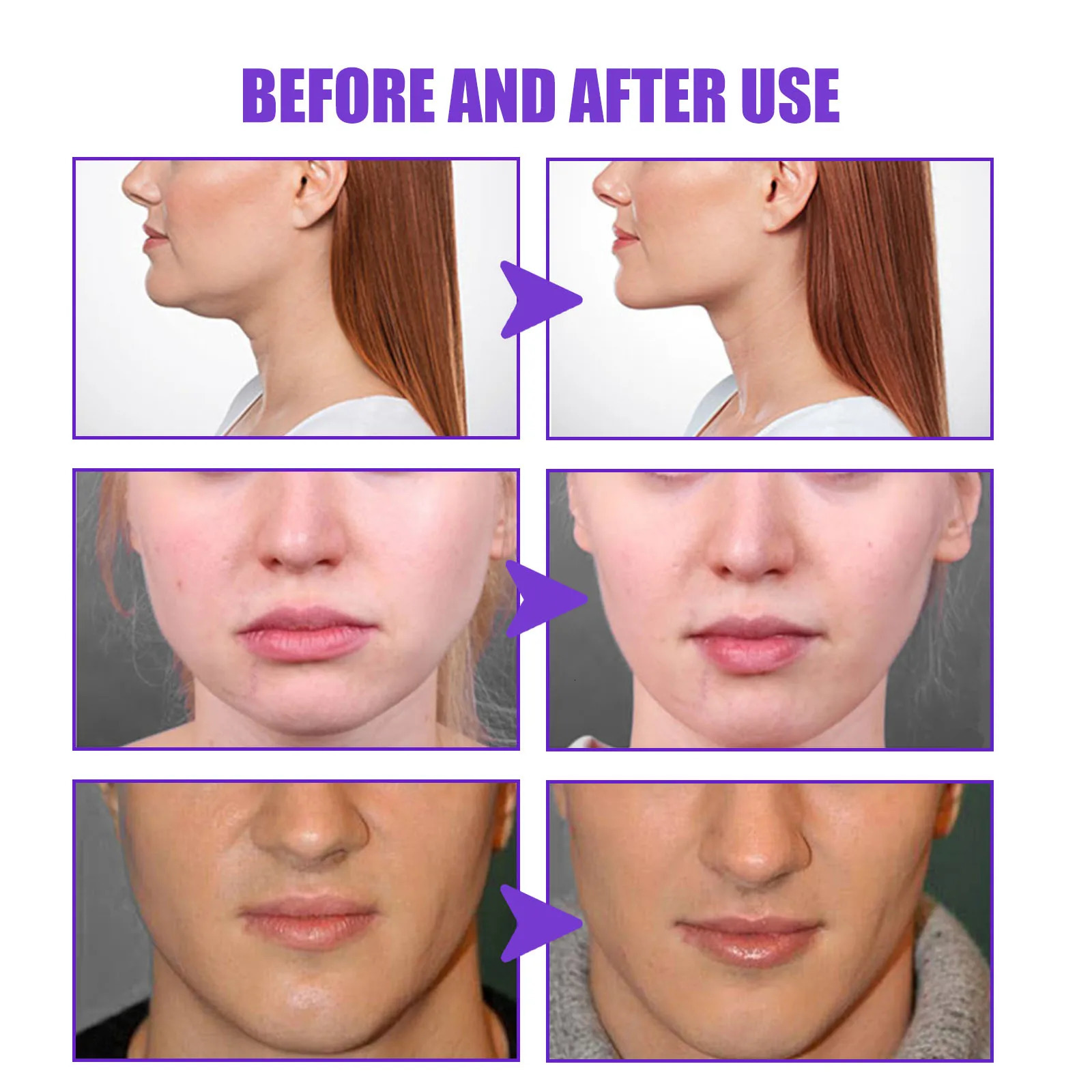 JAYSUING Micro-face CreamV Face CreamInstant Face Lift Cream Formula for 240702