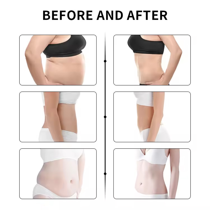New Tech 10600nm Diode Laser Slimming System Fat Burning Machine For Cellulite Reduction Therapy Loss Weight Body Slimming