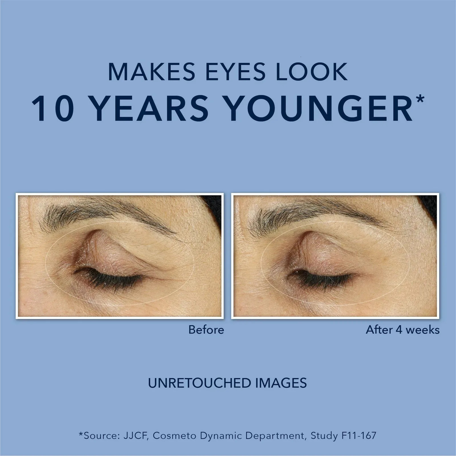 2024 mild and skin friendly retinol anti sturdy eye ointment for dark circles and fluffy eyes to relieve fatigue 240702