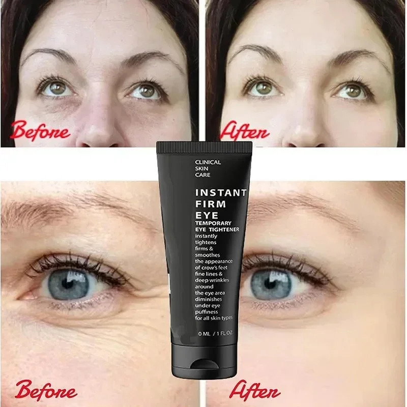 Instant Firm Eye Tightener Anti Dark Circle Care Moisture Cream Eye Bag Removal Corrector Lifting Eye Contour Original 240704