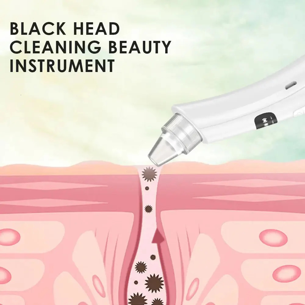 Rapid decline in inventory transportation temptation mode cleaning and beauty machine dead skin removal vacuum blackhead removal skin removal 240704
