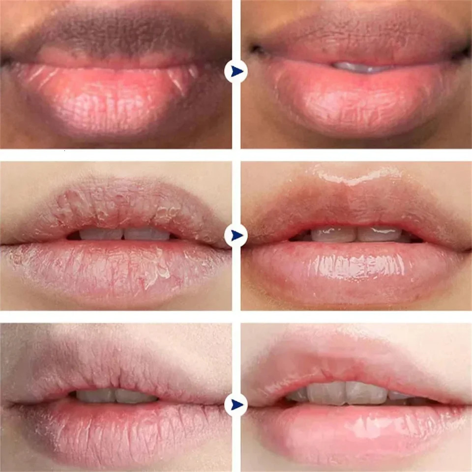 Strawberry Lip Mask Fade Lip Fines Dark Smoke Lip Balm Melanin Bleaching Serum Moisturizing Korean Cosmetics 240705