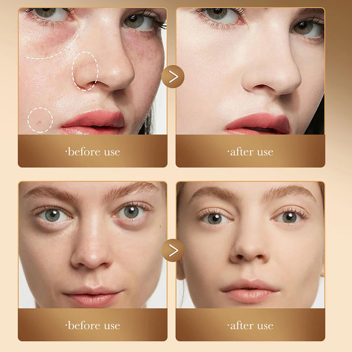 3 Colors Concealer for Multiple Skin Tones Artistic Tri-Color Concealer Natural Color Precise Concealer Evens and Brightens 240705