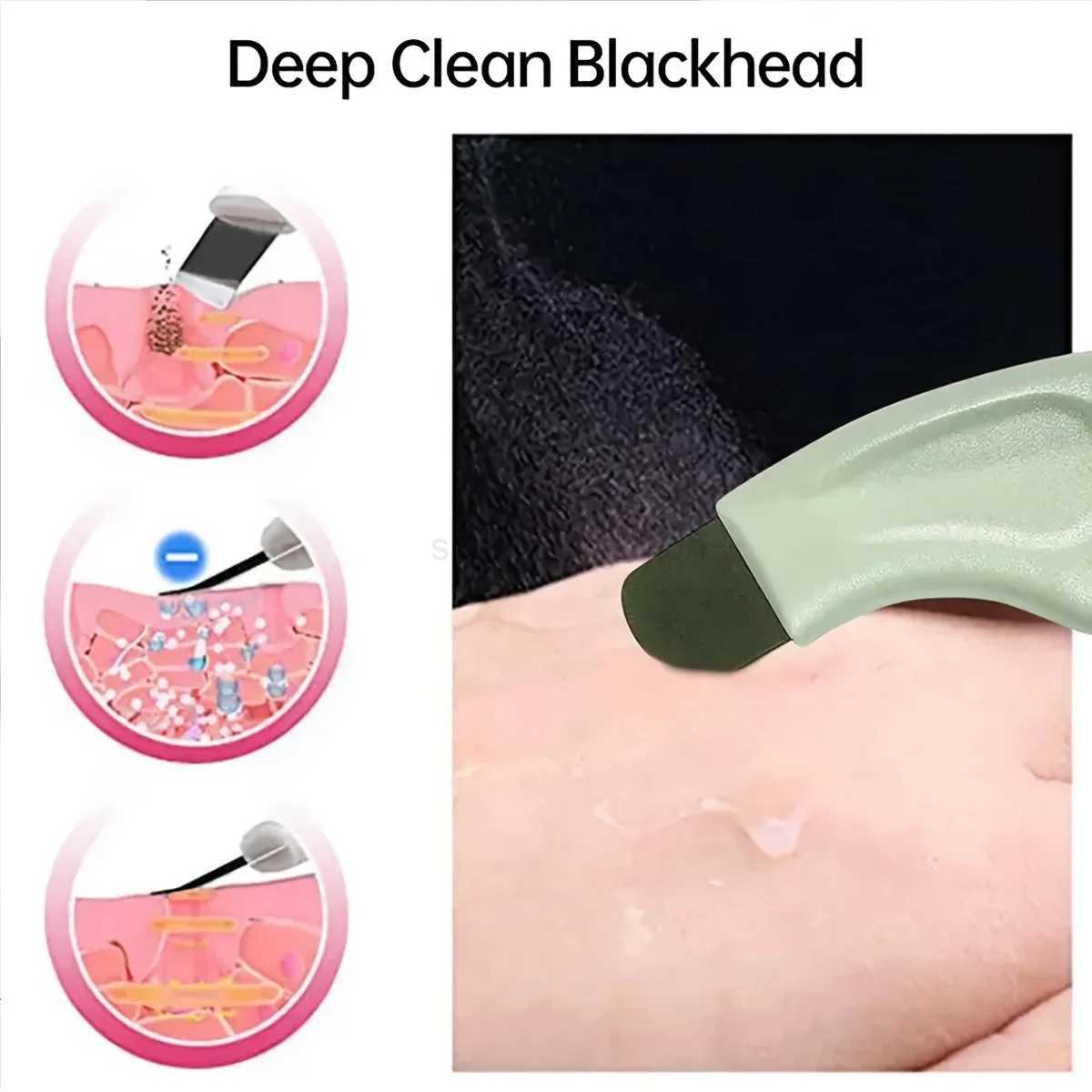 Blackhead and Whitehead Removal Tool for Nose and Face - Skin Pore Cleaner Skin Care Tools for WomenCL240708