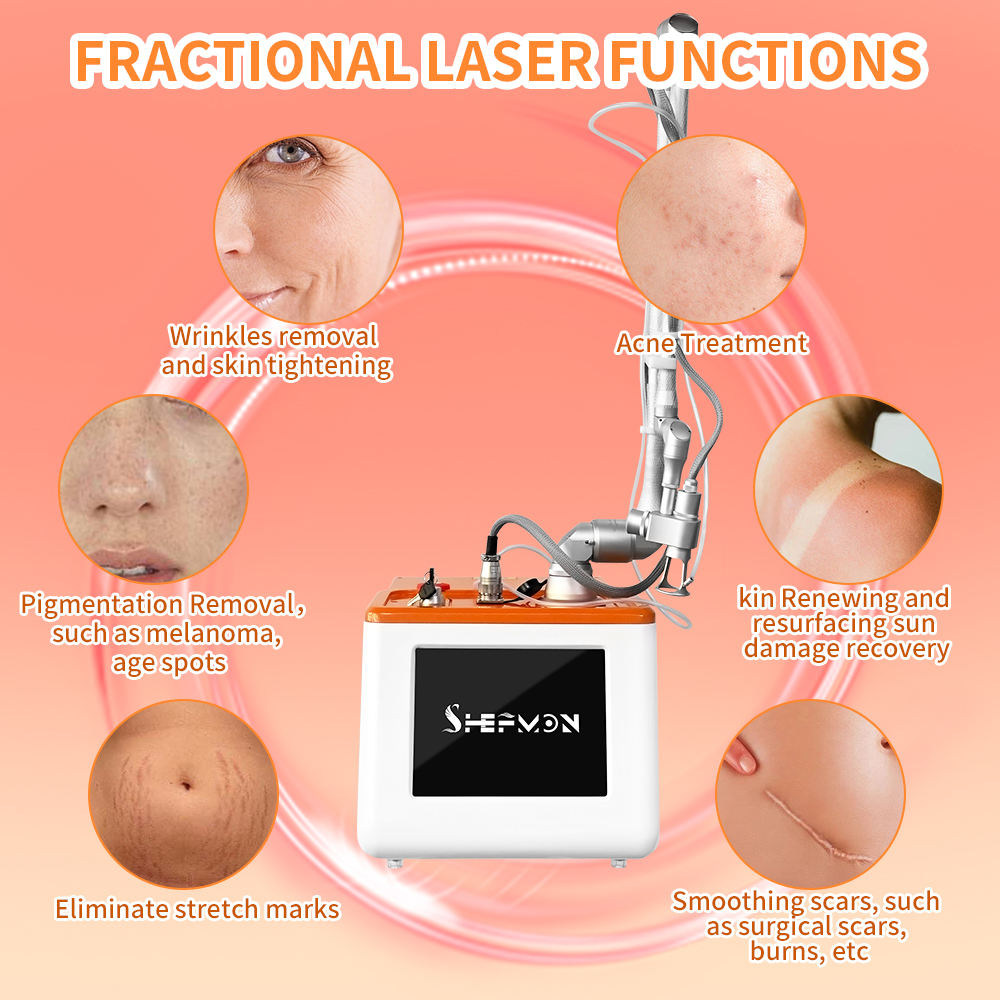 Most Advanced Fractional CO2 Laser 10600nm Skin Smoothing Epidermal Superficial Skin Peel Acne Treatment Dot Matrix Anti-aging Vaginal Care Portable M