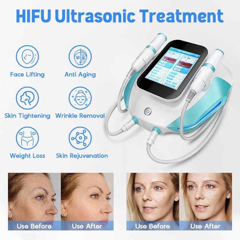 New Technology HIFU Machine Body Tightening Face Lifting High Intensity Focused Ultrasound RF Machine Skin Rejuvenation Wrinkle Removal Machine