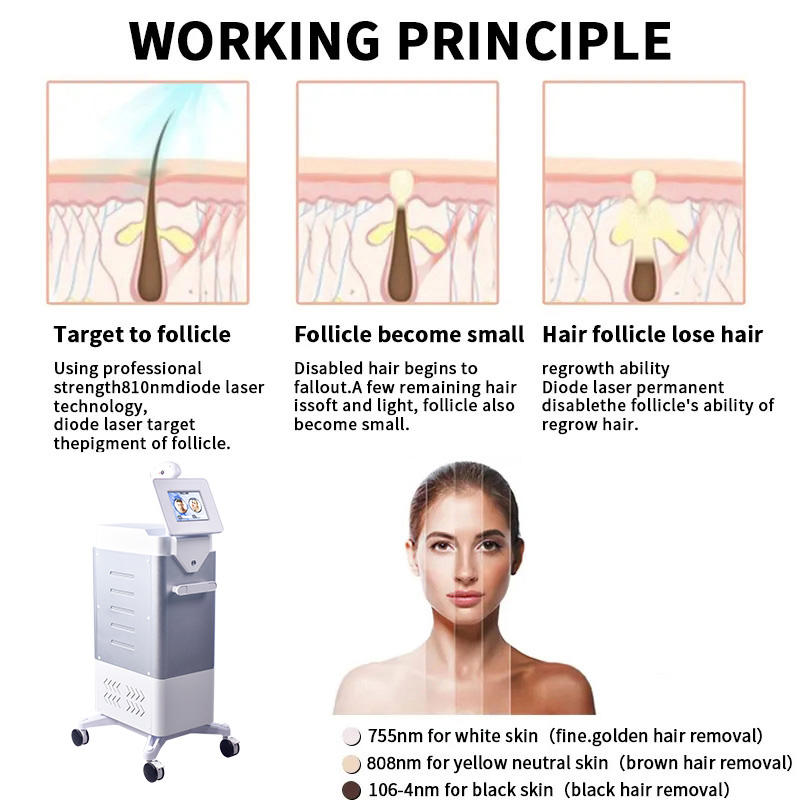 2 IN 1 Ce Approved 808nm Diode Laser Diode Laser Hair Removal 755 808 1064nm Machine Nd-Yag Laser Tattoo Removal Machine