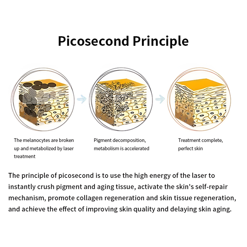 Picosecond 808 Diodo Laser Beauty Machine Rejuvenation Pico Second Laser Tattoo Removal Diode Laser 808Nm Hair Remova