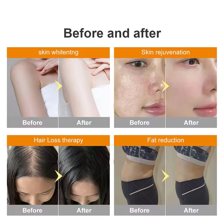 Full Body Infrared Red LED Light Therapy Treatment Fat Burn Weight Loss Skin Tighten Physiotherapy solarium tanning Bed