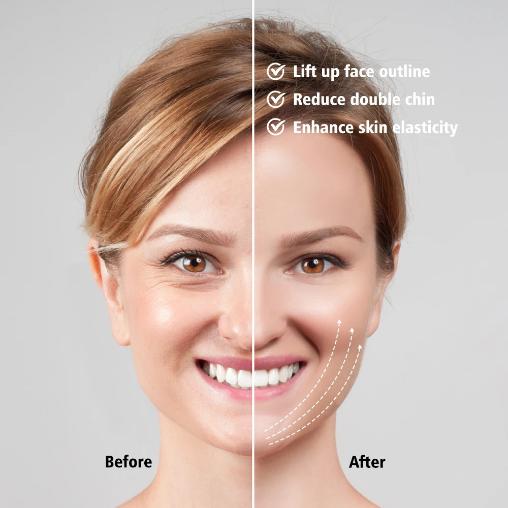 Lift V-Line Double Chin Removal Skin Care Massage Machine Compression Skin Regeneration Beauty Equipment 240713