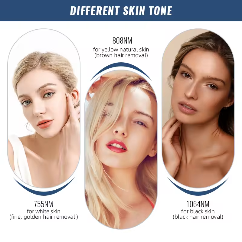 OPT hair removal machine IPL hair removal equipment Laser freezing point hair remove skin Rejuvenation machine