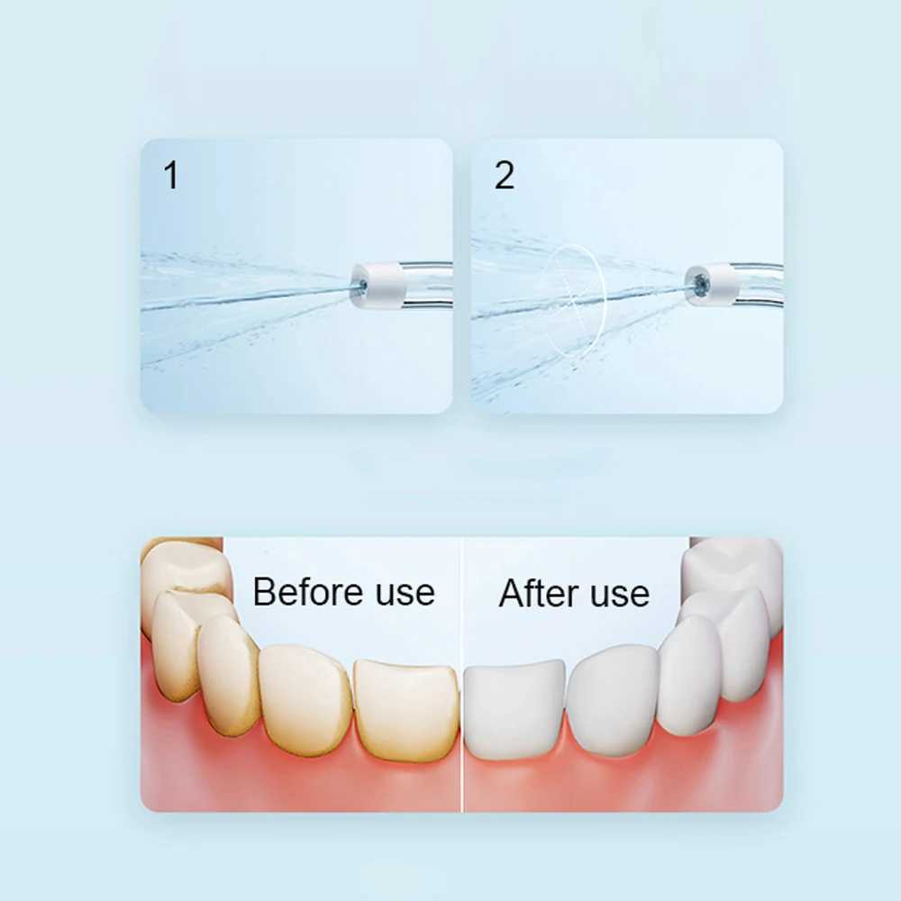 Other Oral Hygiene XIAOMI MIJIA F300 Portable Oral Irrigator Dental For Irrigator Teeth Water Flosser Bucal Calculi Oral Cleaner water thread TeethL47
