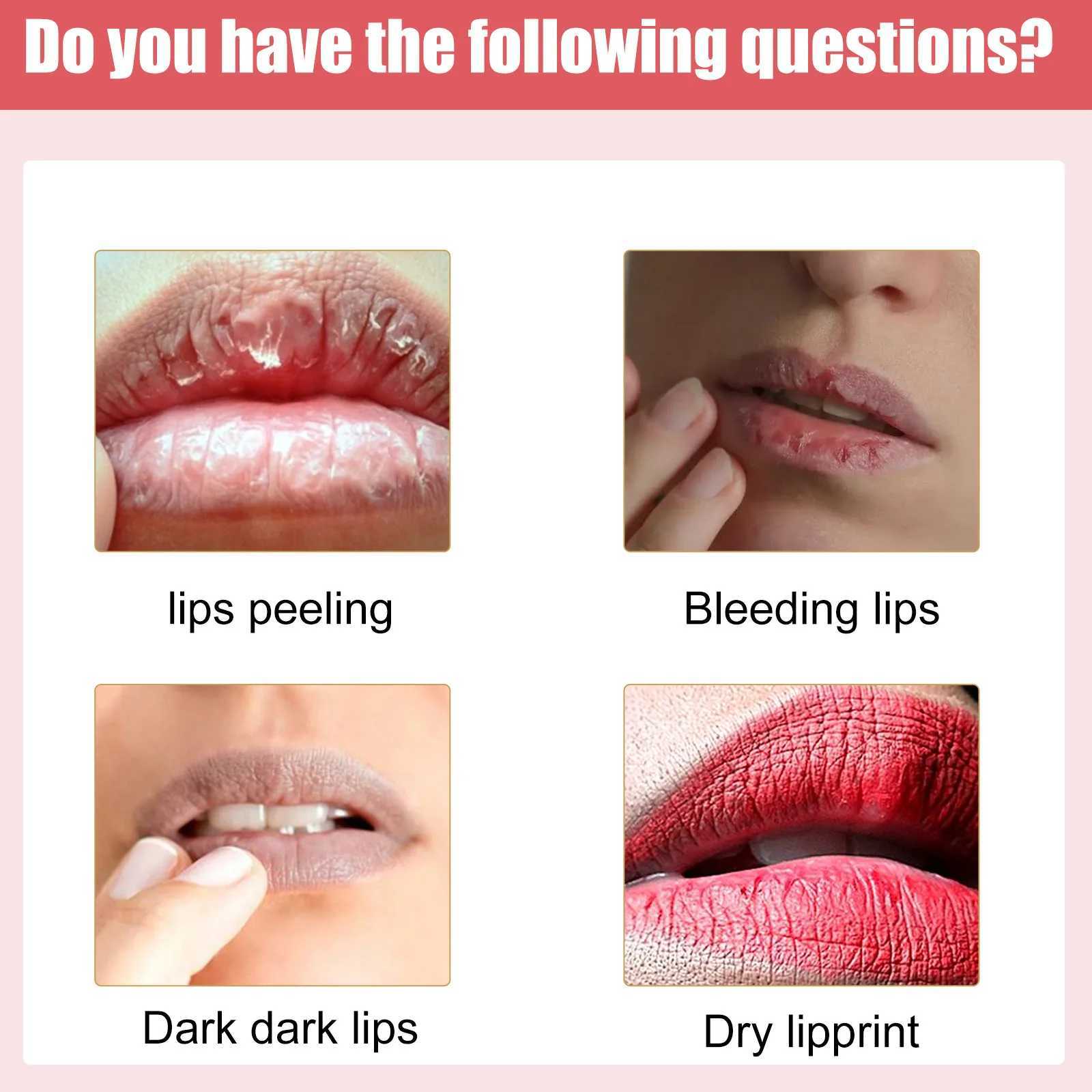 EELHOE Lip Moisturizing and Whitening Cream Whitening Pigments Black Smoke Lip Removal Dead Skin Treatment Lip CreamW241223