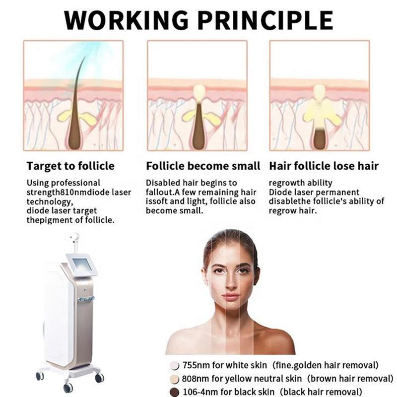 Newest Q Switched 808 Hair Removal Ice Cooling System ND Yag Laser Tattoo Removal Picosecond Laser Skin Rejuvenation Pico Laser Machine