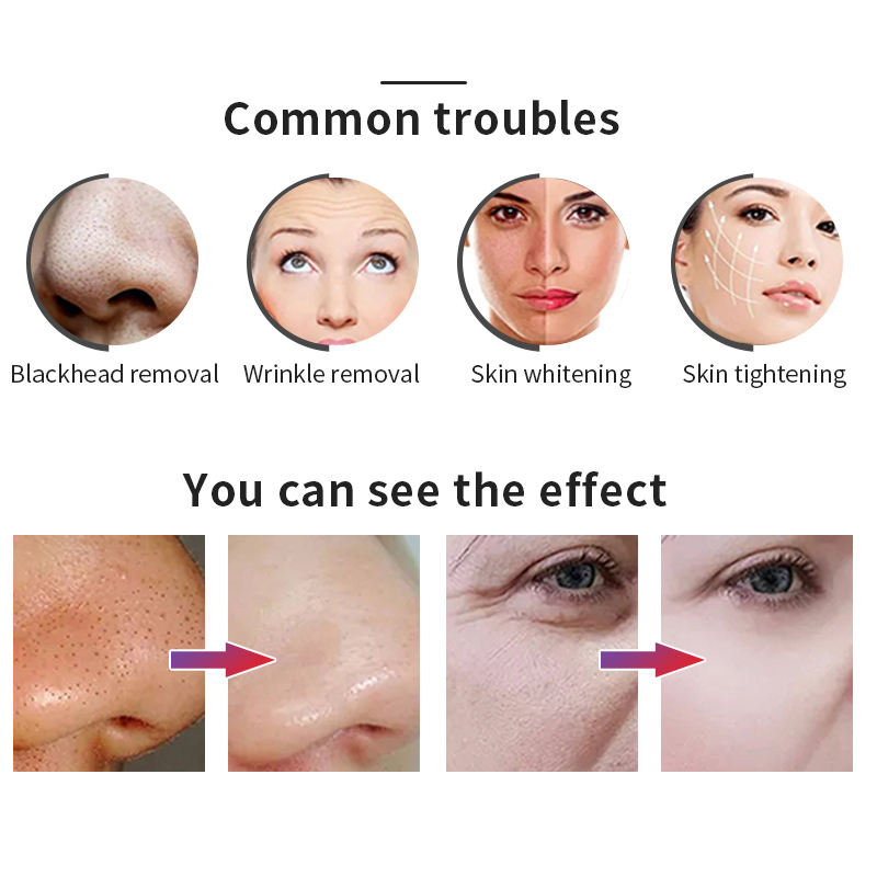 Multifunctional Beauty Dermabrasion Aqua Peeling Oxygen Jet Spray RF Face Lifting Skin Exfoliator Beauty Deep Cleaning Black Head Remover Machine