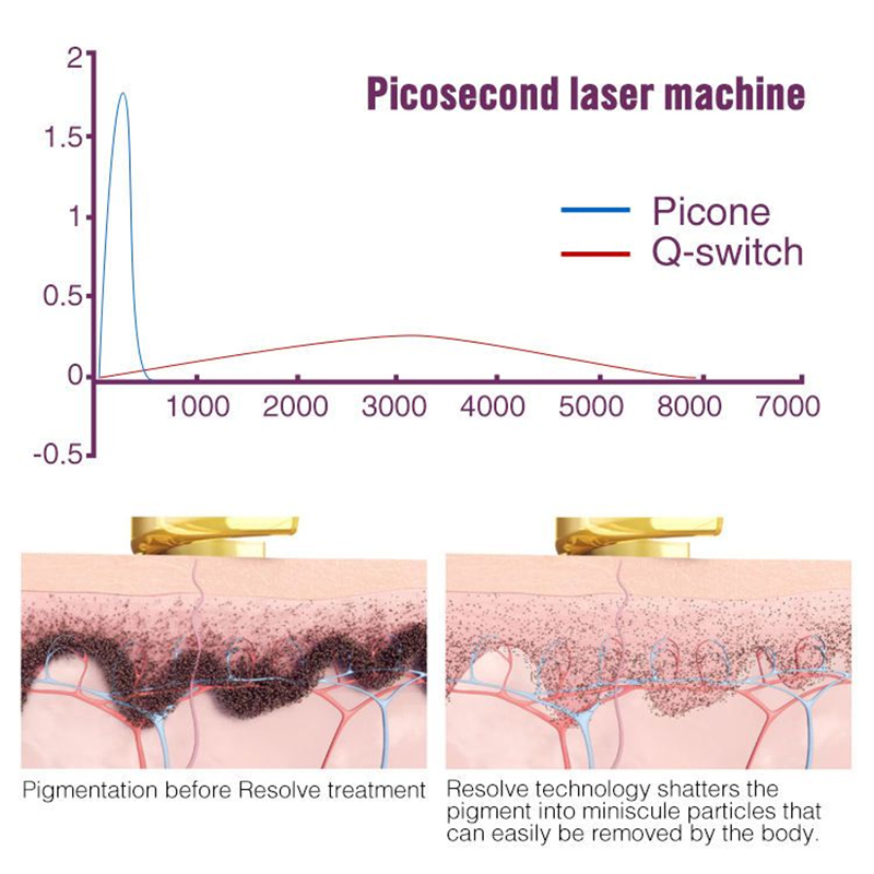 Laser Eyebrow Washing Nd Yag Q Switch Vertical Picosecond Laser Tattoo Removal Honeycomb Peel Head 755nm Pigment Remover Skin Rejuvenation Machine
