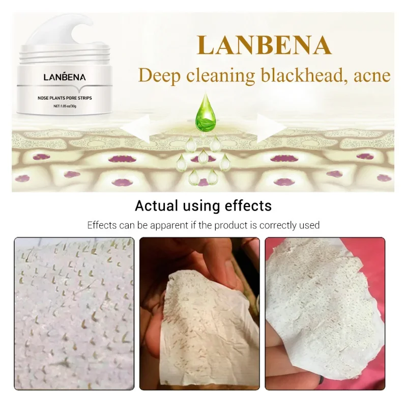 LANBENA Blackhead Remover Face Mask Pore Strip Black Mask Peeling Acne Treatment Face Deep Cleansing Skin Care Korea Cosmetics
