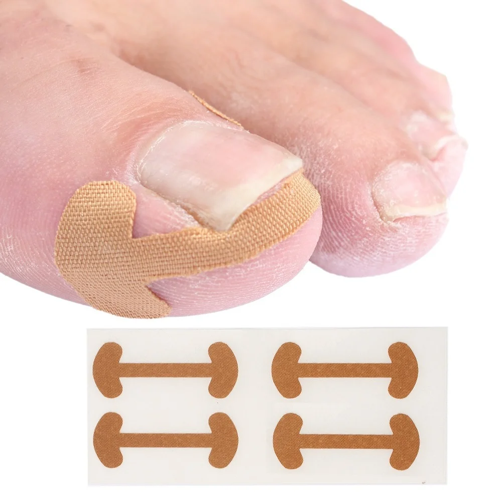 20pcs Professional Ingrown Toenail Foot Corrector Stickers Elasticity Toe Nail Care Pedicure Tools Health Care Protects Toe Nail