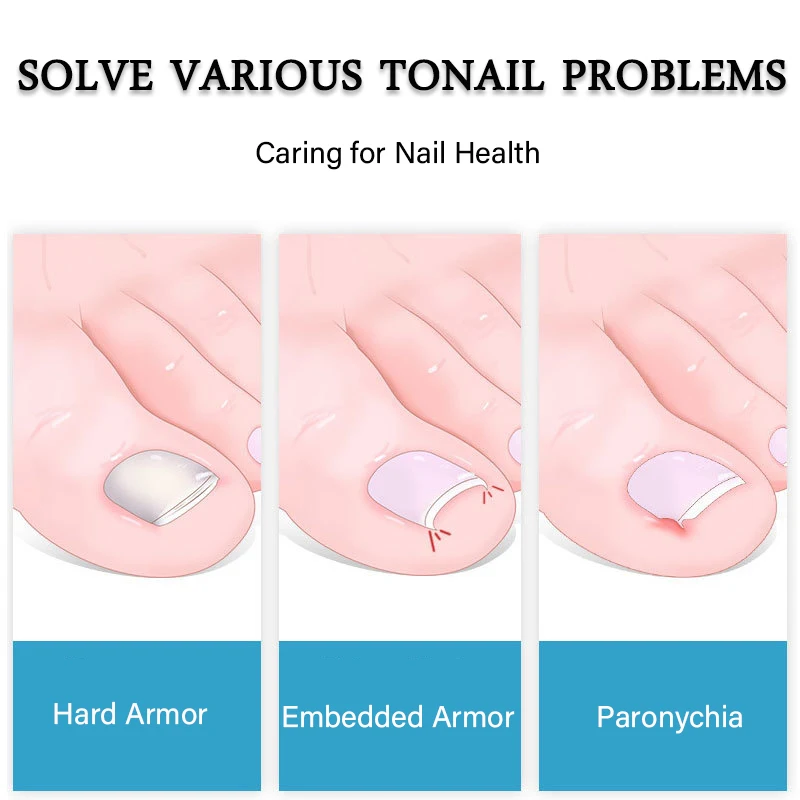 2025 Professional Toe Nail Clippers Cutter ingrown toenail tool Thick Nails new Dead Skin Dirt Remover Super Sharp Curved Blade Nail Tool