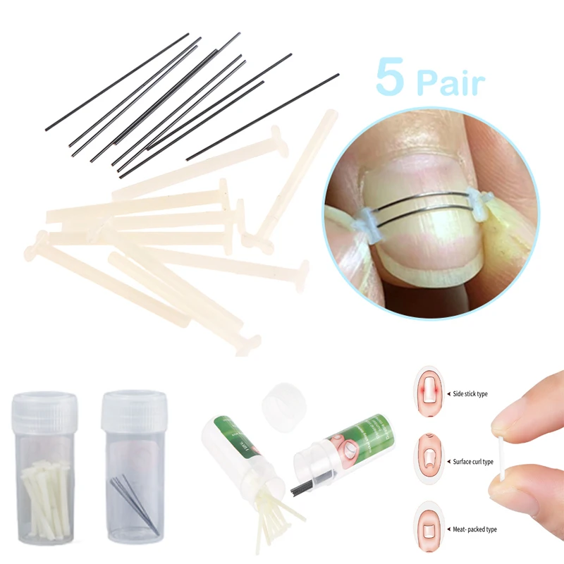 10/50pcs Ingrown Toenail Corrector Tools Ingrown Toe Nail Treatment Elastic Patch Sticker Straightening Clip Brace Pedicure Tool