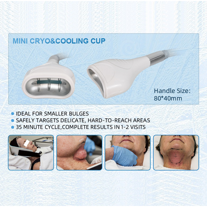 4D Maquina Cryolipolysis Laser Lipo Slimming RF Lose Weight Cavitation Cooling Fat Cryo Therapy Machine