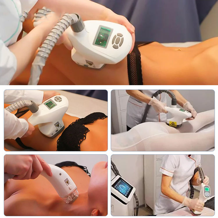 5 in 1 vacuum roller rf cavitation reduce cellulite sculpt body machine vacuum cavitation reduce cellulite