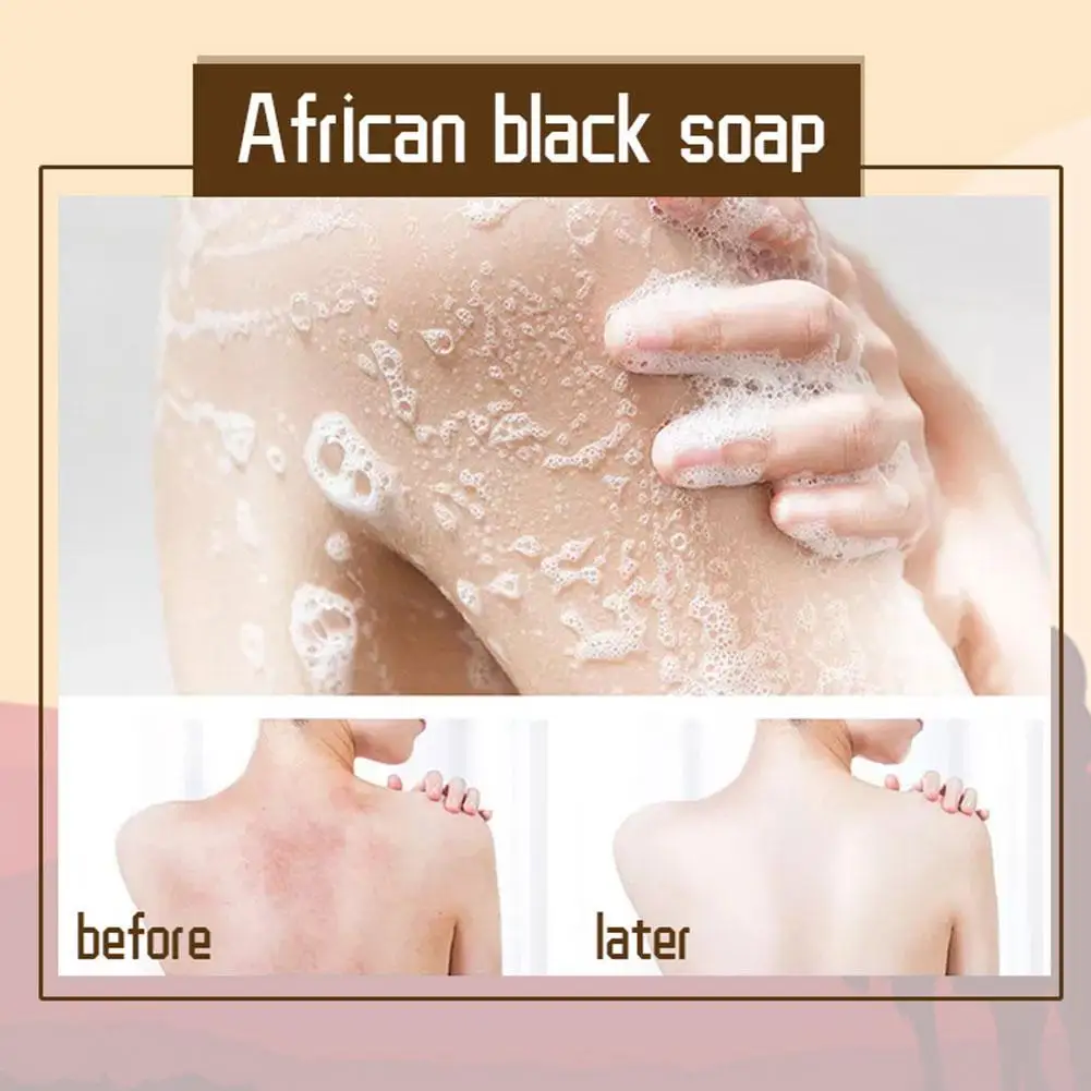 1 * Beauty Black Soap African Black Soap Dark Black Skin Lightening Soap 2025 new Brighten Face Body Skin Beauty Bath Body Bleaching Soap