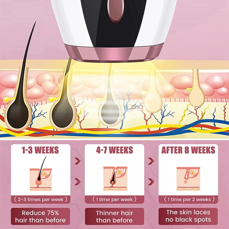 Hair MYWIN Freezing Point Removal Device Armpit Household ddmysmile Shaving Instrument US Plug Smile